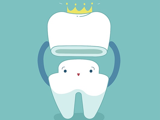 cartoon of dental crowns in Coral Springs