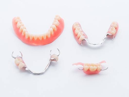 four different types or dentures