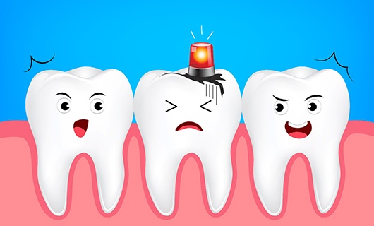 tooth illustration for cost of emergency dentistry in Coral Springs 
