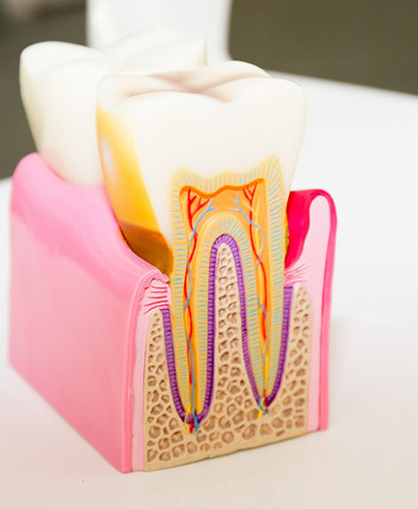Model of a tooth showing the root canals and layers inside of it