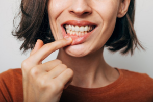Woman pulling back her lip to reveal her gums
